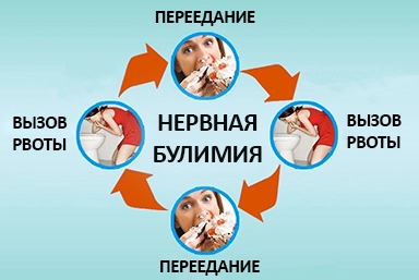 Лечение булимии в Тосно